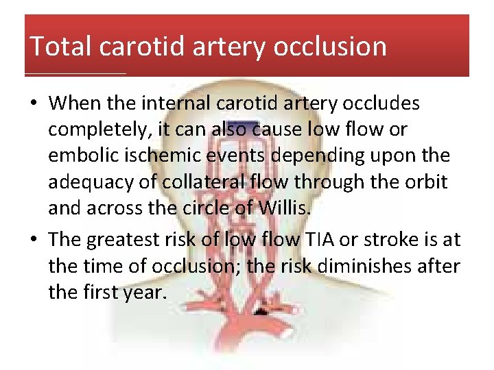 Total carotid artery occlusion • When the internal carotid artery occludes completely, it can
