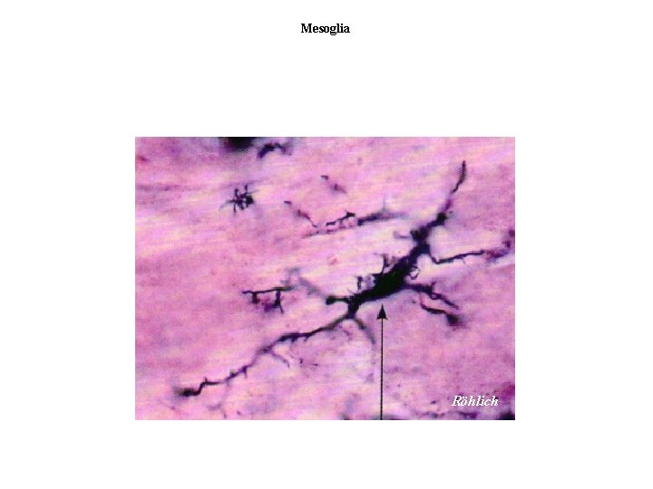 Mesoglia Röhlich 