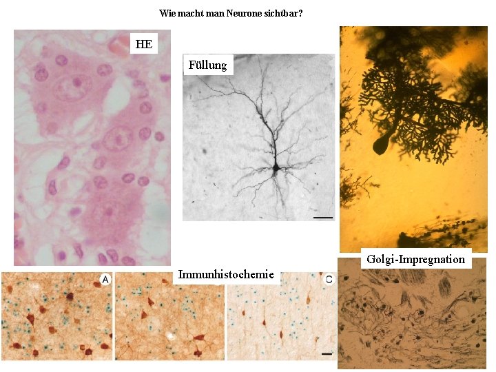 Wie macht man Neurone sichtbar? HE Füllung Golgi-Impregnation Immunhistochemie 