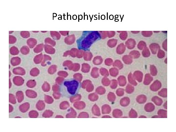 Pathophysiology 