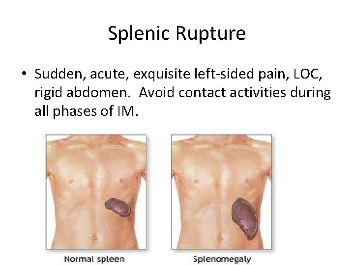 Splenic Rupture • Sudden, acute, exquisite left-sided pain, LOC, rigid abdomen. Avoid contact activities