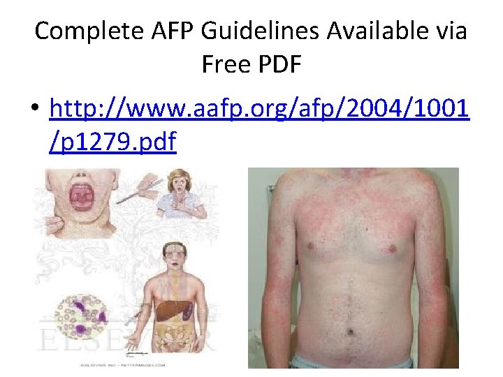 Complete AFP Guidelines Available via Free PDF • http: //www. aafp. org/afp/2004/1001 /p 1279.