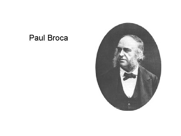 Paul Broca 