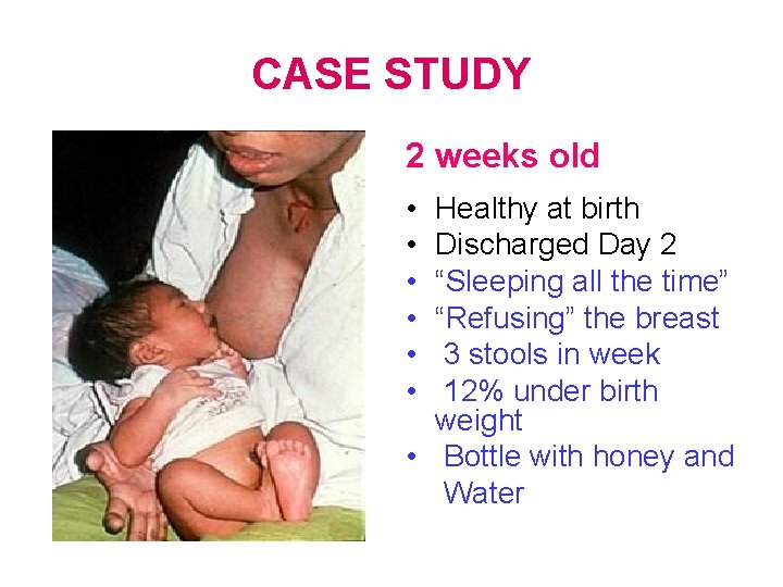 CASE STUDY 2 weeks old • • • Healthy at birth Discharged Day 2