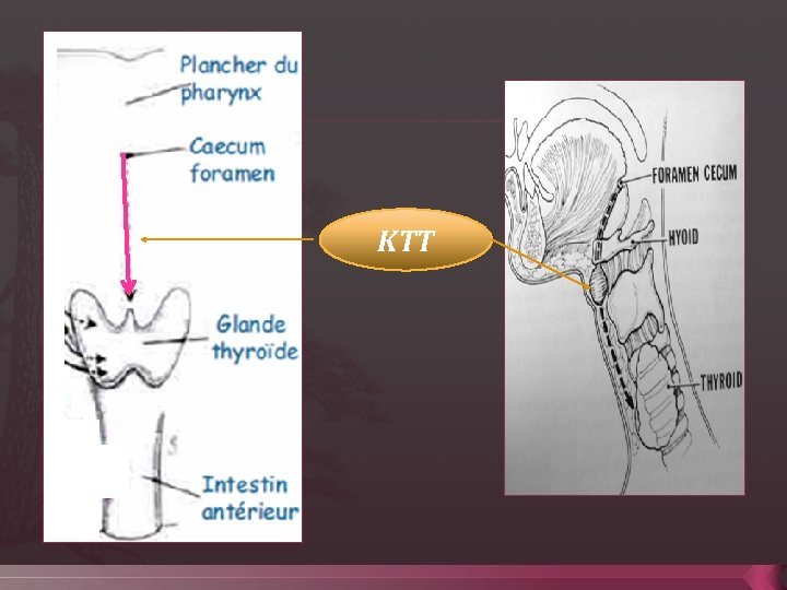 KTT 