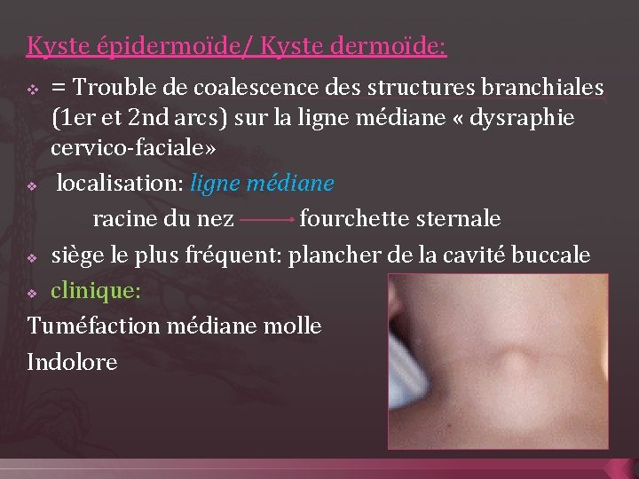 Kyste épidermoïde/ Kyste dermoïde: v = Trouble de coalescence des structures branchiales (1 er