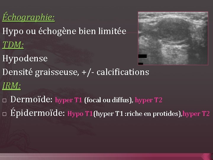 Échographie: Hypo ou échogène bien limitée TDM: Hypodense Densité graisseuse, +/- calcifications IRM: �