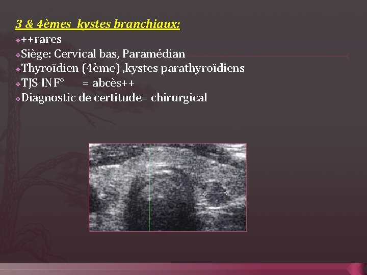 3 & 4èmes kystes branchiaux: v++rares v. Siège: Cervical bas, Paramédian v. Thyroïdien (4ème)