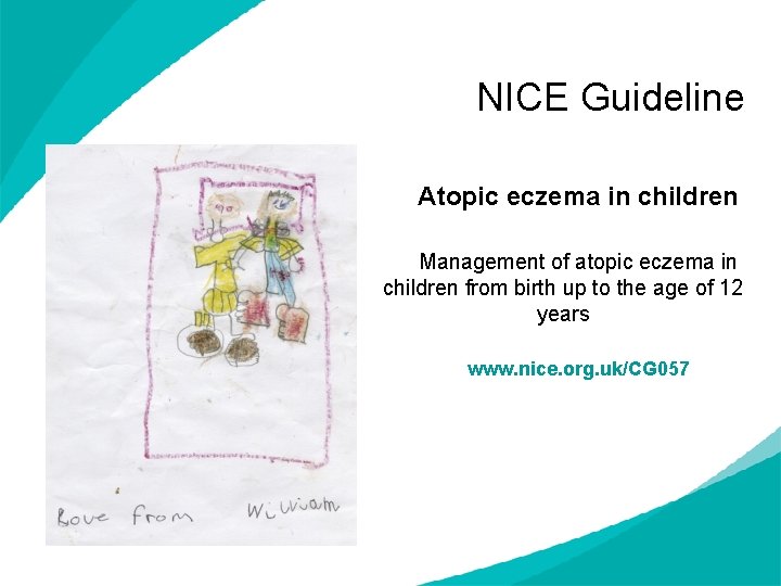 NICE Guideline Atopic eczema in children Management of atopic eczema in children from birth