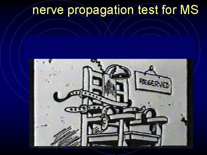 nerve propagation test for MS 