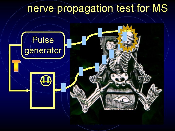 nerve propagation test for MS Pulse generator 