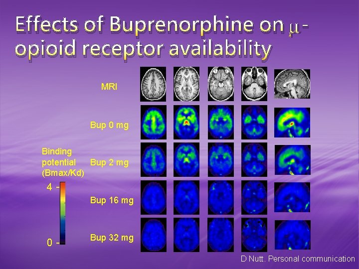 Effects of Buprenorphine on opioid receptor availability MRI Bup 0 mg Binding potential Bup