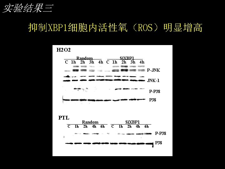 实验结果三 抑制XBP 1细胞内活性氧（ROS）明显增高 H 2 O 2 C 1 h Random 2 h 3