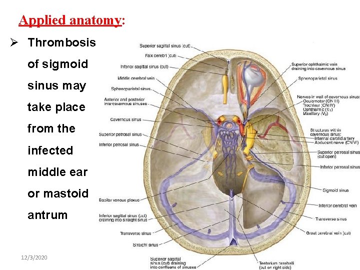 Applied anatomy: Ø Thrombosis of sigmoid sinus may take place from the infected middle