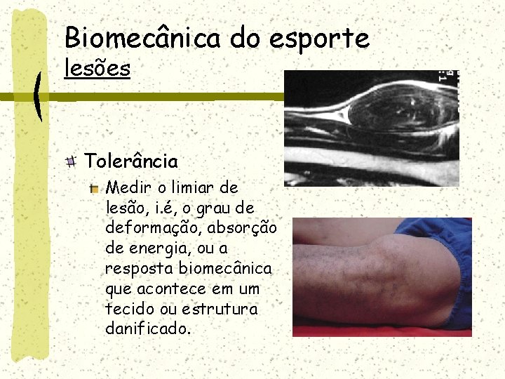 Biomecânica do esporte lesões Tolerância Medir o limiar de lesão, i. é, o grau Biomecânica do esporte lesões Tolerância Medir o limiar de lesão, i. é, o grau