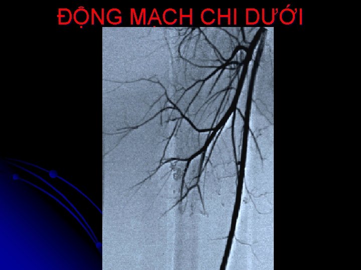 ĐỘNG MẠCH CHI DƯỚI 