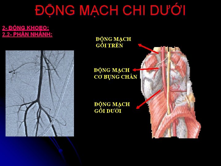ĐỘNG MẠCH CHI DƯỚI 2 - ĐỘNG KHOEO: 2. 2 - PH N NHÁNH: