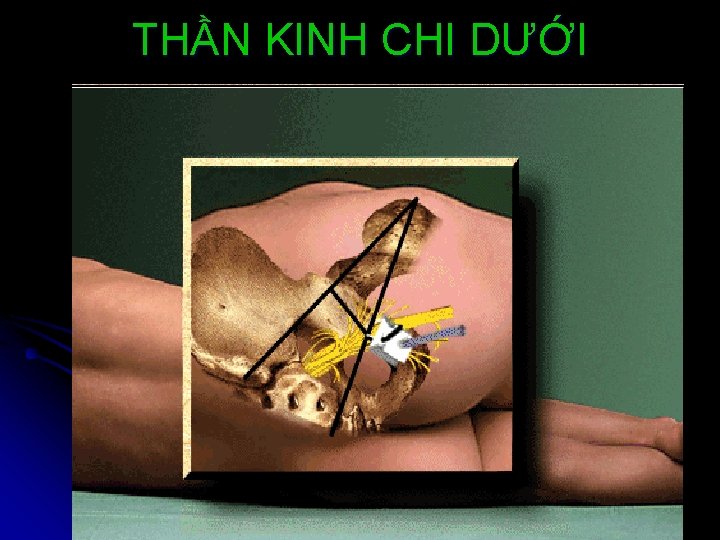 THẦN KINH CHI DƯỚI 