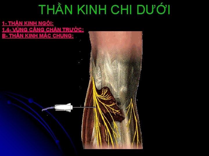 THẦN KINH CHI DƯỚI 1 - THẦN KINH NGỒI: 1. 4 - VÙNG CẲNG