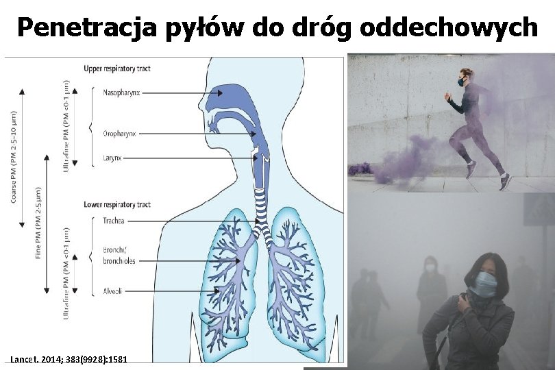 Penetracja pyłów do dróg oddechowych Lancet. 2014; 383(9928): 1581 