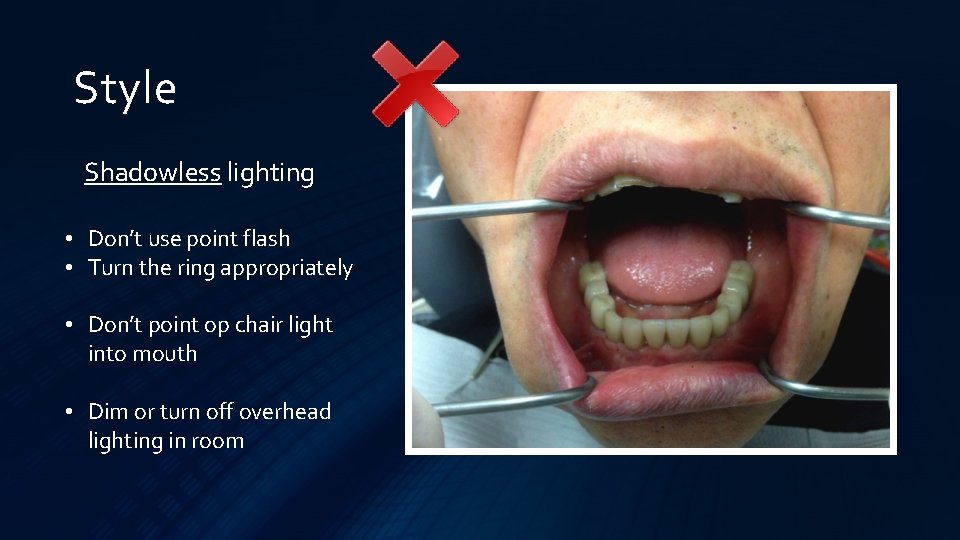 Style Shadowless lighting • Don’t use point flash • Turn the ring appropriately •