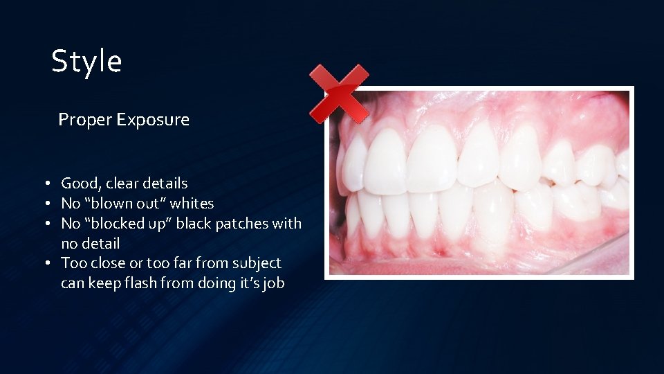 Style Proper Exposure • Good, clear details • No “blown out” whites • No