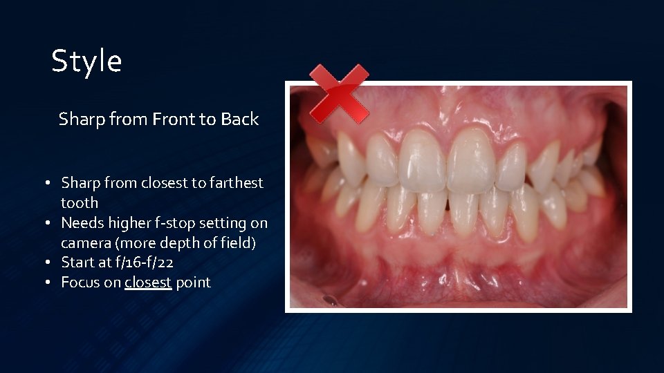 Style Sharp from Front to Back • Sharp from closest to farthest tooth •