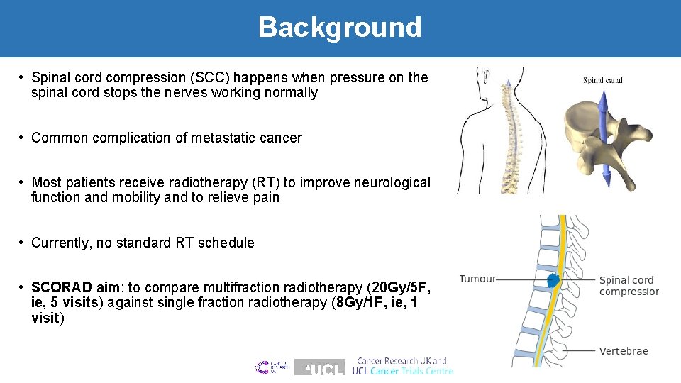 Background • Spinal cord compression (SCC) happens when pressure on the spinal cord stops