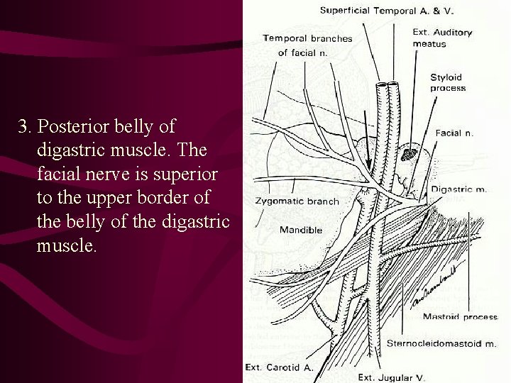 3. Posterior belly of digastric muscle. The facial nerve is superior to the upper