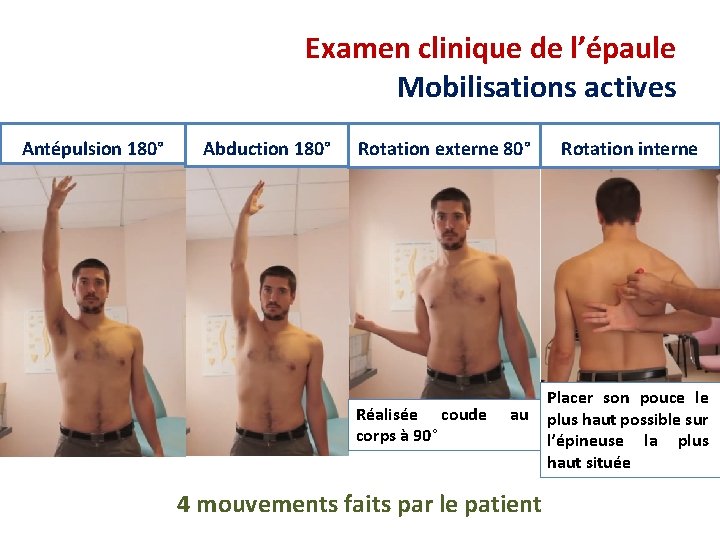 Examen clinique de l’épaule Mobilisations actives Antépulsion 180° Abduction 180° Rotation externe 80° Réalisée