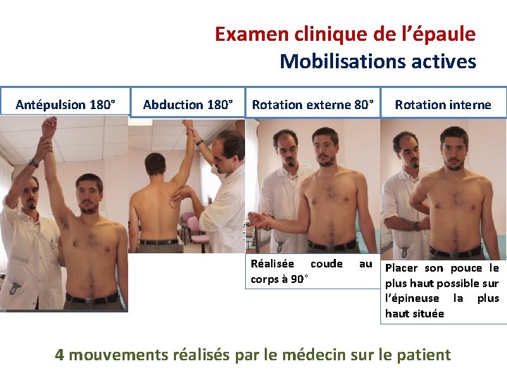 Examen clinique de l’épaule Mobilisations actives Antépulsion 180° Abduction 180° Rotation externe 80° Réalisée