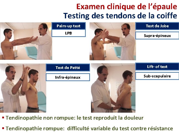 Examen clinique de l’épaule Testing des tendons de la coiffe Palm-up test LPB Test