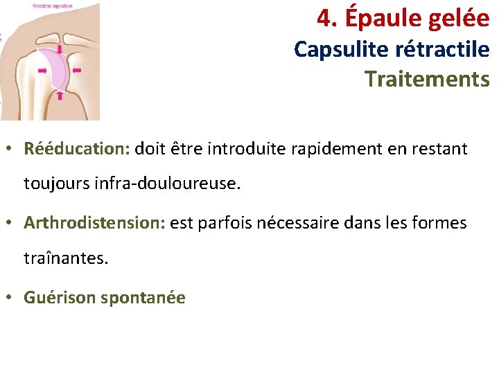 4. Épaule gelée Capsulite rétractile Traitements • Rééducation: doit être introduite rapidement en restant
