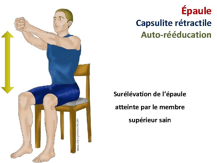 Épaule Capsulite rétractile Auto-rééducation Surélévation de l’épaule atteinte par le membre supérieur sain 