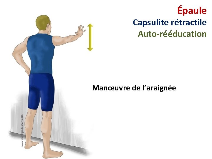 Épaule Capsulite rétractile Auto-rééducation Manœuvre de l’araignée 