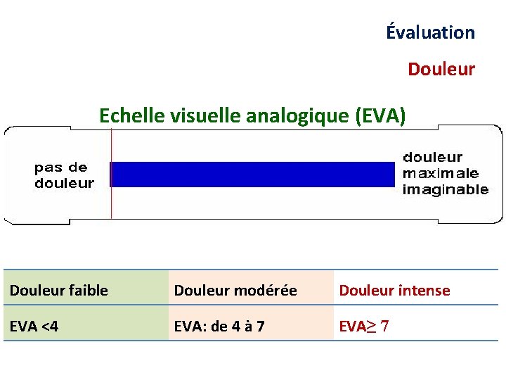 Évaluation Douleur Echelle visuelle analogique (EVA) Douleur faible Douleur modérée Douleur intense EVA <4
