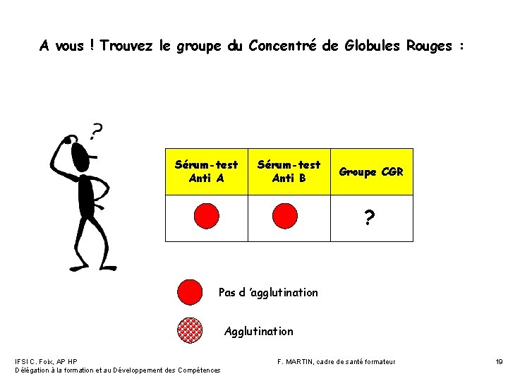 A vous ! Trouvez le groupe du Concentré de Globules Rouges : Sérum-test Anti A vous ! Trouvez le groupe du Concentré de Globules Rouges : Sérum-test Anti