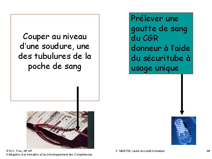 Couper au niveau d’une soudure, une des tubulures de la poche de sang IFSI Couper au niveau d’une soudure, une des tubulures de la poche de sang IFSI