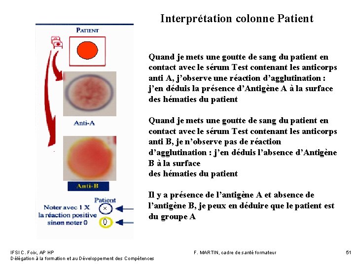 Interprétation colonne Patient Quand je mets une goutte de sang du patient en contact Interprétation colonne Patient Quand je mets une goutte de sang du patient en contact