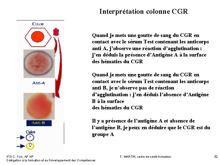 Interprétation colonne CGR Quand je mets une goutte de sang du CGR en contact Interprétation colonne CGR Quand je mets une goutte de sang du CGR en contact