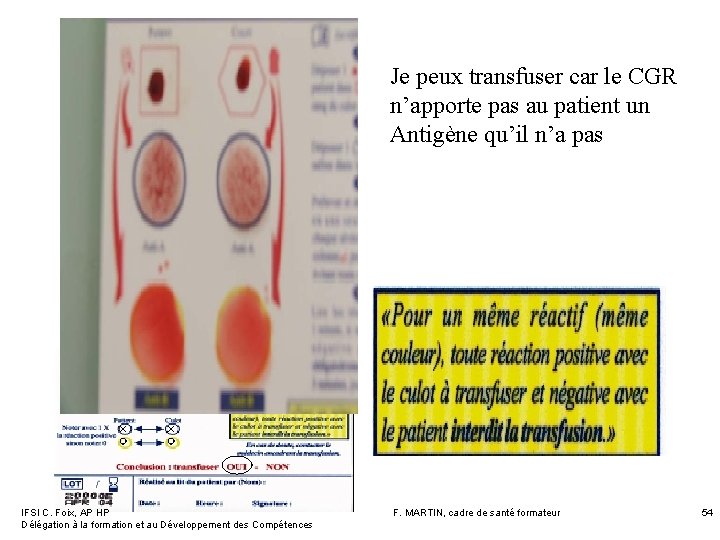 Je peux transfuser car le CGR n’apporte pas au patient un Antigène qu’il n’a Je peux transfuser car le CGR n’apporte pas au patient un Antigène qu’il n’a