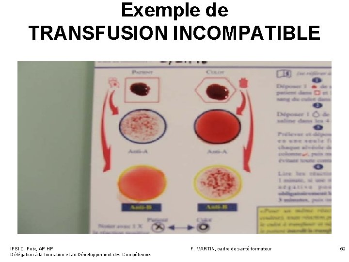 Exemple de TRANSFUSION INCOMPATIBLE IFSI C. Foix, AP HP Délégation à la formation et Exemple de TRANSFUSION INCOMPATIBLE IFSI C. Foix, AP HP Délégation à la formation et