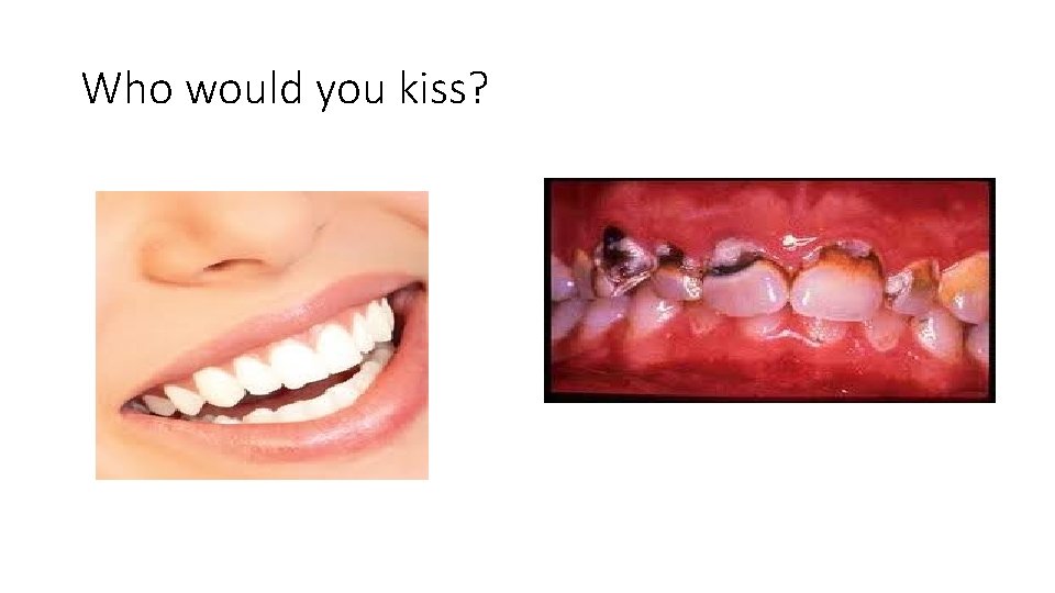 Who would you kiss? 