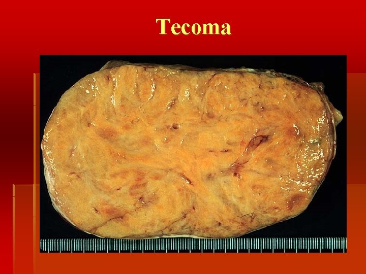 Tecoma 