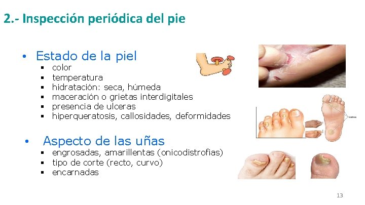 2. - Inspección periódica del pie • Estado de la piel § § §