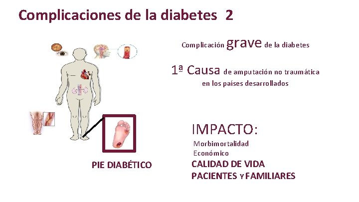 Complicaciones de la diabetes 2 Complicación grave de la diabetes 1ª Causa de amputación