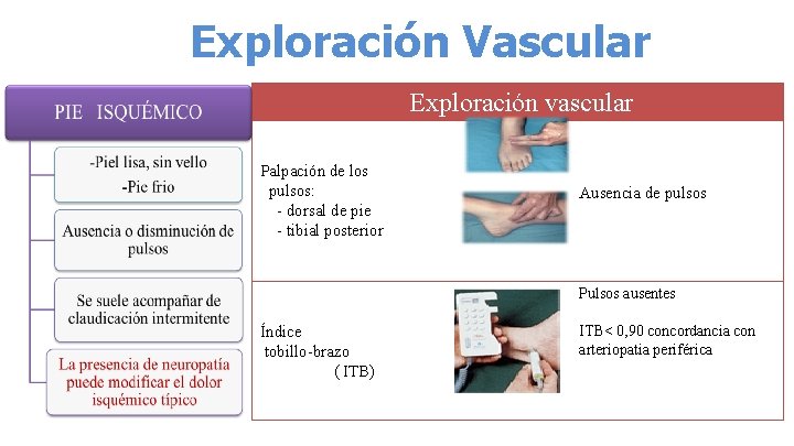 Exploración Vascular Exploración vascular Palpación de los pulsos: - dorsal de pie - tibial