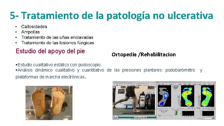 5 - Tratamiento de la patología no ulcerativa Estudio del apoyo del pie Ortopedia