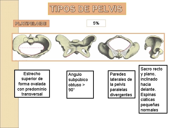 TIPOS DE PELVIS 5% PLATIPELOIDE Estrecho superior de forma ovalada con predominio transversal Angulo TIPOS DE PELVIS 5% PLATIPELOIDE Estrecho superior de forma ovalada con predominio transversal Angulo