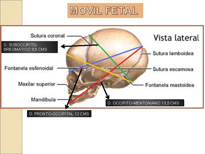 MOVIL FETAL D. SUBOCCIPITOBREGMATICO 9, 5 CMS D. OCCIPITO-MENTONIANO 13, 5 CMS D. FRONTO-OCCIPITAL MOVIL FETAL D. SUBOCCIPITOBREGMATICO 9, 5 CMS D. OCCIPITO-MENTONIANO 13, 5 CMS D. FRONTO-OCCIPITAL